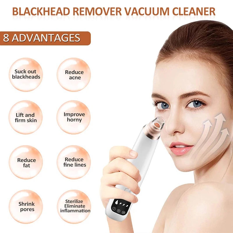 Blackhead/Pore Remover/Cleaner -RoHS Approved